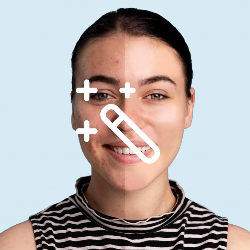 Retouching